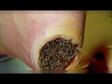 10 Most Terrifying Medical Treatments In History